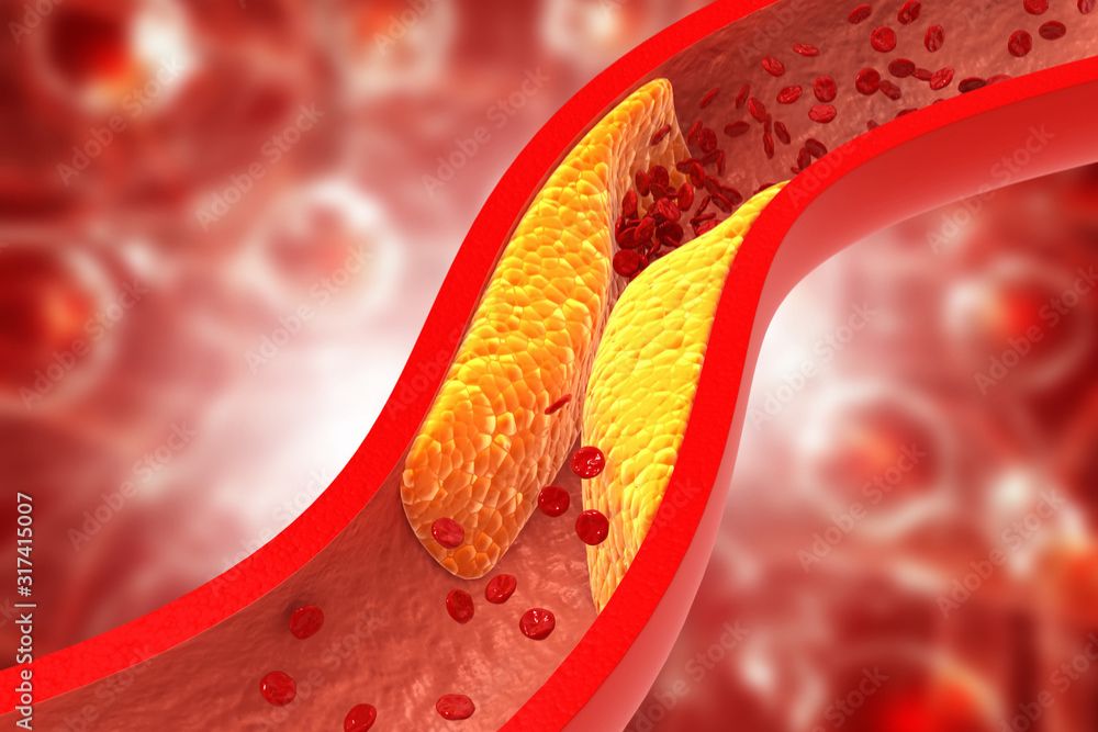 Cholesterol