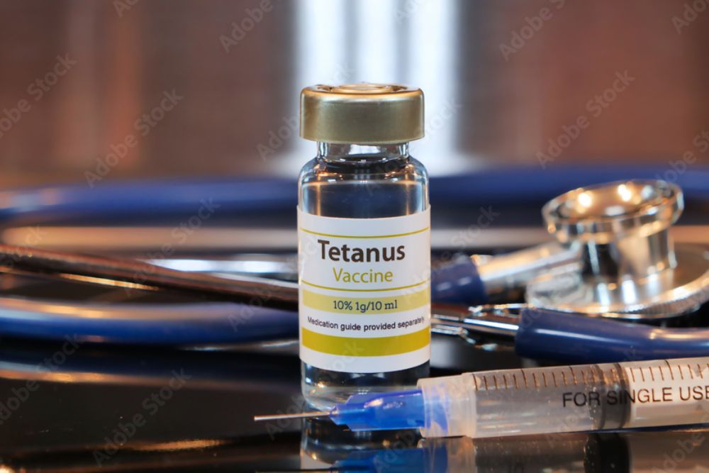 TETANUS IgG